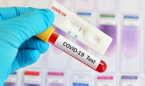 Teste rápido de Covid-19 continua sendo realizado na cidade