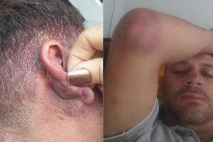 Caminhoneiro diz que PMs o agrediram em hospital de em Águas Lindas