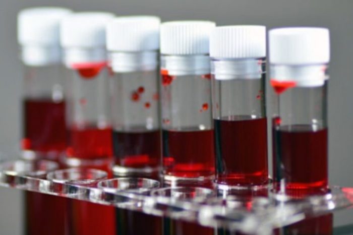 Cientistas descobrem novo grupo sanguíneo que era um mistério há quatro décadas