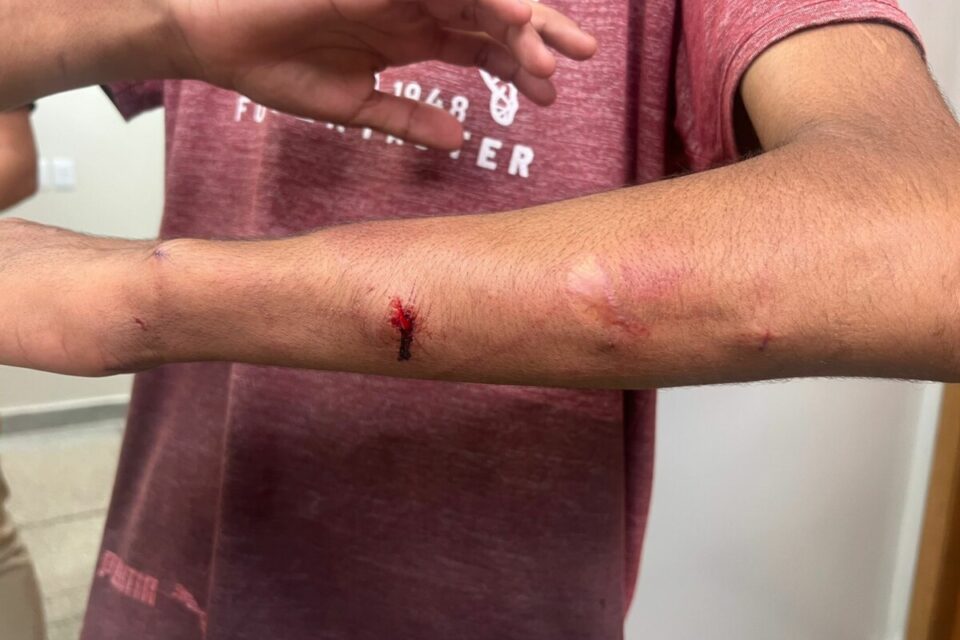 Pai é preso após espancar filhos com facão em Águas Lindas