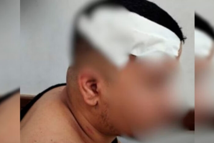 Jovem é agredido com pedaço de madeira após fazer brincadeira durante partida de truco em Goiânia