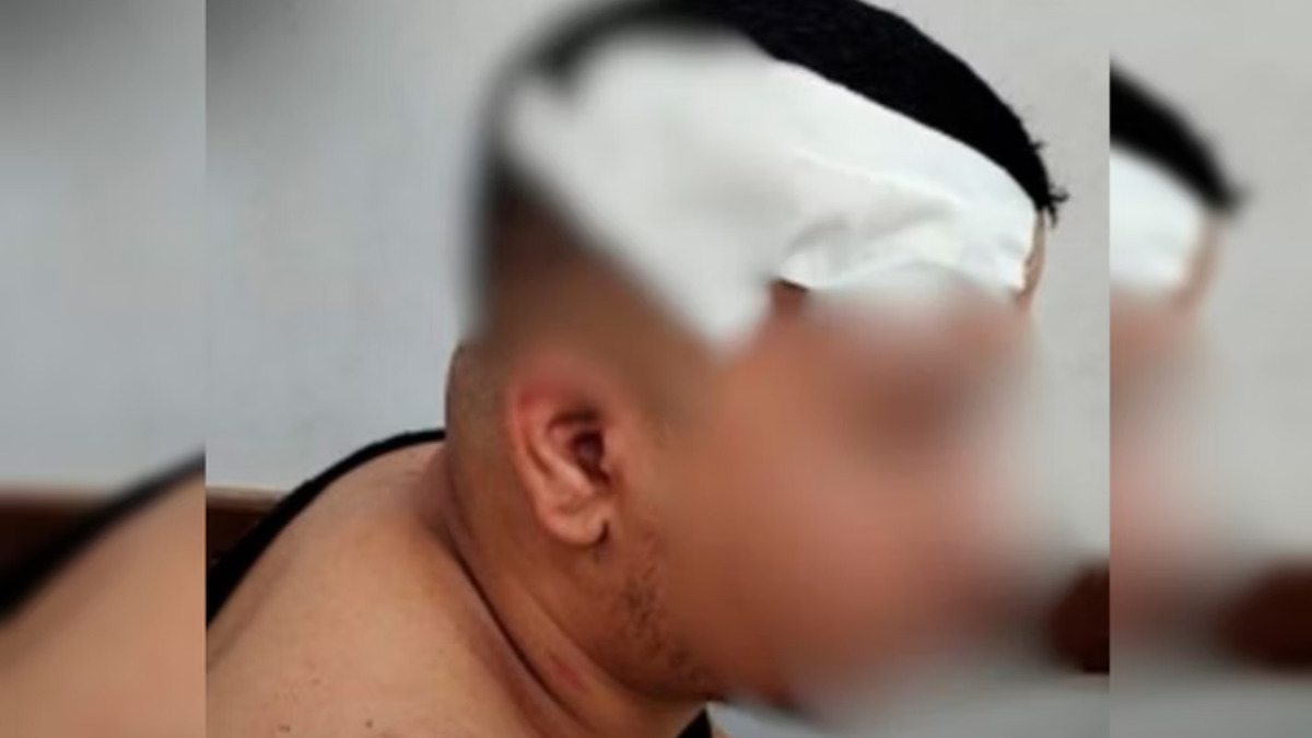 Jovem é agredido com pedaço de madeira após fazer brincadeira durante partida de truco em Goiânia
